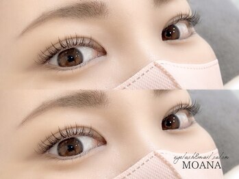 アイラッシュサロンモアナ 梅田芝田店(MOANA)/LEDエクステ120本