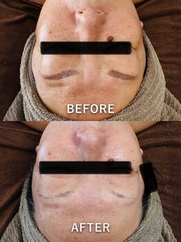 ルーク(Luke)/くすみケア