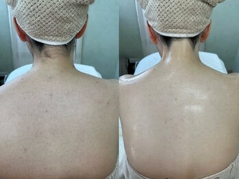 ソルシエール/うなじ×背中