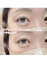 レディエント(Radiant)/パリジェンヌ/メーテル