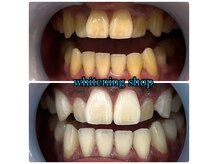 汚れを落としていきます！！