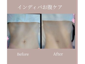 カノン(Kanon.)/インディバボディ