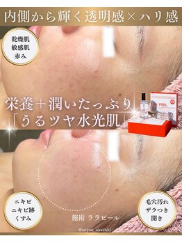 ソユ(SOYOU)/施術* ララピール