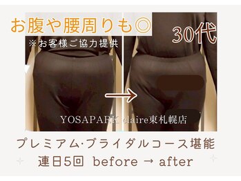 ヨサパーク クレール 東札幌店(yosa park claire)/プレミアムダイエットコース成果