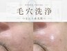 【黒ずみ/ザラつき】を整える水光毛穴洗浄＋デコルテ &nbsp;¥8,500→ 