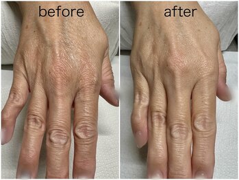 トノワ 目白(Tnoi)の写真/指先だけで終わらせない。乾燥もくすみもケアする完全個室のハンドエステ