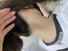 ナノハナ/鹿沼市の全身脱毛美容室ナノハナ