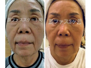 スパチャーレ(Spa ciare)/肌ファス