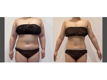 リリーパッソ(Lily passo)/痩身メニューも充実！機械もあり