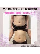 サロン ド パーフェクション(Salon de Perfection)/エムスレンダー１ヶ月通い放題