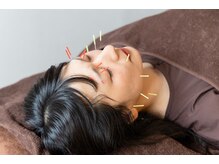 キューサッポロ(SalonQSapporo)の雰囲気（当院の最新美容鍼で小顔調整、リフトアップもおまかせください！）