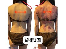 ベリップ 横浜店(Berip)