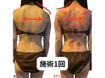 ベリップ 横浜店(Berip)