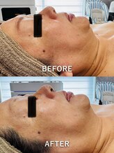 ルーク(Luke)/くすみケア