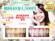 ホワイトニングショップ 福岡春日店