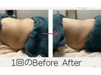 ダイエット サポート(DIET SUPPORT)/Billy