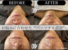アングレイス(Anngrace)の雰囲気（【技】と【理論】で“あなた”だけのパーソナルサロンケアを実現）