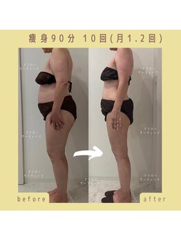 ナンバーサーティーン(NUM13ER)の写真/理想のボディラインへ!しっかり温める痩身で、痩せやすい健康的な身体へ♪コリ・むくみ・冷え改善にも◎