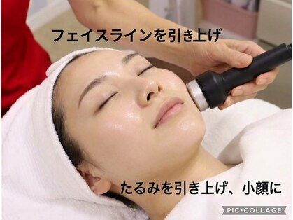 オリーブ(Olive)の写真