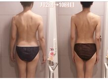 マテリアル 痩身骨気サロン(MATERIAL)