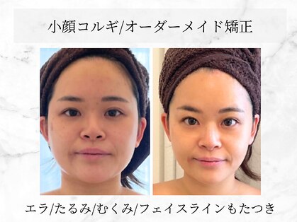 ラーナ(Lana)の写真