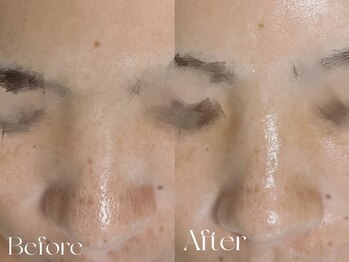 ウィハナ(wehana)/【ララピール】敏感肌/乾燥肌