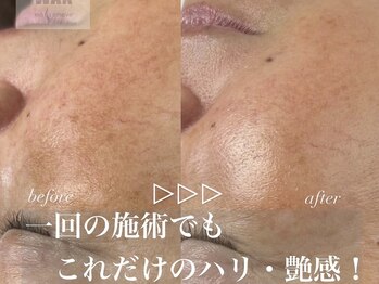 ベルード(veludo)/