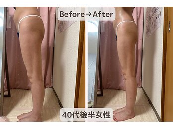 ピーチ(Peach)/骨盤矯正×ダイエット×美尻