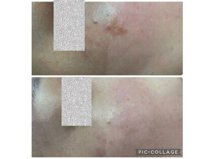 シンプル(Simple)の写真