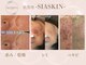 肌管理-SIASKIN-【4/1 NEW OPEN（予定）】の写真