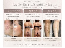 リノリー 石巻店(rinory)の雰囲気（ピーリング/痩身/脱毛/毛穴洗浄）