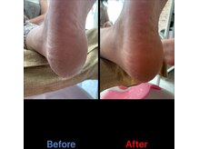 クイーナクルー(QUEENA CLUE)/足の裏の角質メニュー