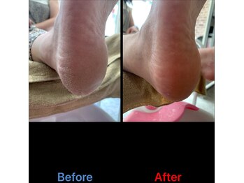 クイーナクルー(QUEENA CLUE)/足の裏の角質メニュー