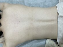 ナノハナ/鹿沼市の全身脱毛美容室ナノハナ