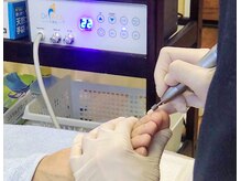 専用のマシンを使用しケアします。