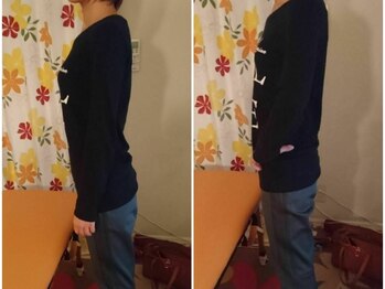トータルケアサロン 寿の写真/猫背等の姿勢の歪みは、身体全体の不調の要因!!もみほぐし×姿勢矯正で気持ちよく美姿勢に変わる♪