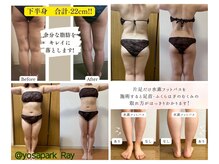ヨサパーク レイ 等々力(YOSA PARK Ray)の雰囲気（食事制限、運動なし！座るだけダイエットでデトックス♪）