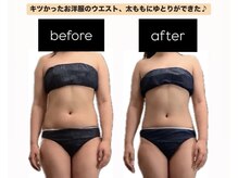 スラン(Slan)/美骨痩身×筋膜リリース90分