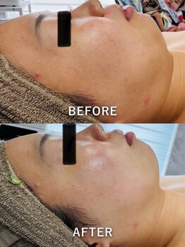 ルーク(Luke)/くすみ/毛穴ケア