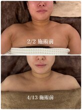 ソアー(Soar)/小顔フェイシャル/リンパ