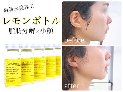 ヴィエンナ VIENNAの写真