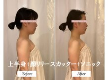 リノ(Lino)/上半身＋顔リリースカッターB&A