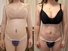 アンドボディ 横浜元町(&Body)/3カップバストUP/くびれ/美姿勢