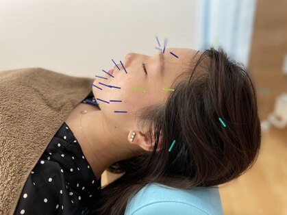 あおき鍼灸整骨院/肩こり/腰痛/整体の写真