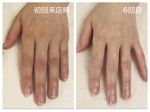 キレイテ 上野店/40代/6回目【ハンドケア稲荷町】