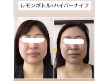 アーニャビューティー(Anya Beauty)