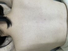 ナノハナ/鹿沼市の全身脱毛美容室ナノハナ