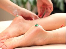 月海/全身鍼灸で身体の不調を全て改善