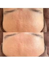 ラエッセ 恵比寿(LAESSE)/毛穴・美白専門店 LAESSE 恵比寿