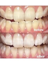 四国健康村 宇多津店/Before After